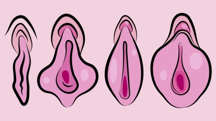 hoe ziet een vagina eruit?